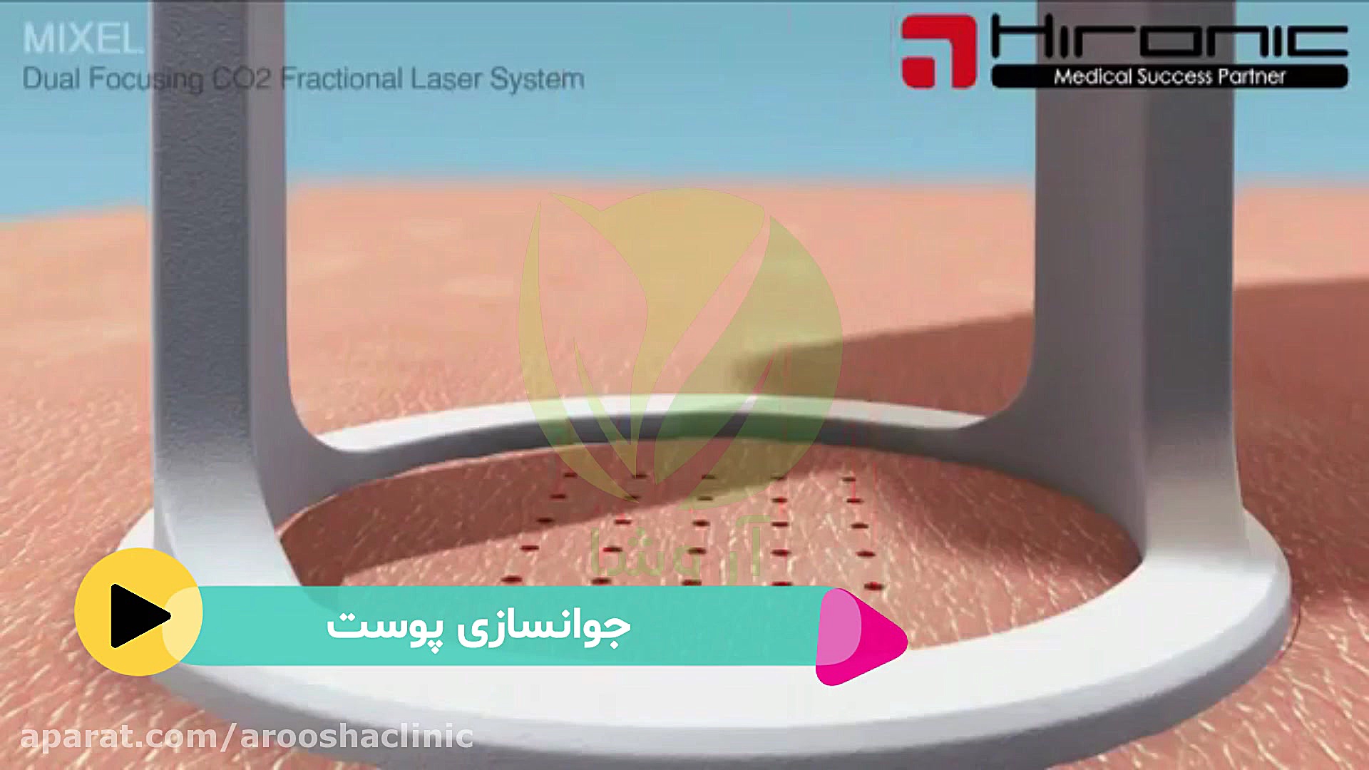 جوانسازی پوست با دستگاه لیزر کلینیک زیبائی دکتر مهرشاد رابط