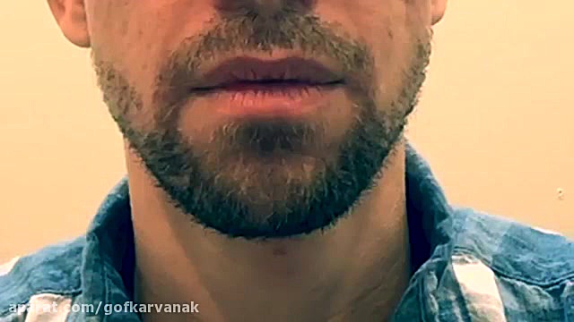 درمان حرف زدن،راه رفتن سکته مغزی،09120452406گفتاردرمانی،کاردرمانی،کاردرمان سکته پلاستیک لثه