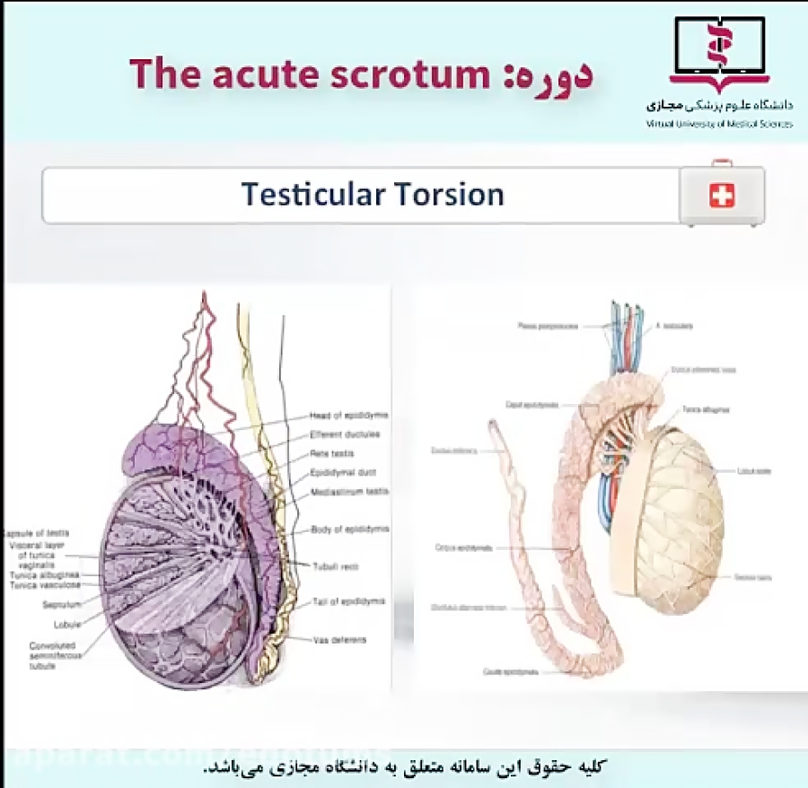 Acute Scrotum دکتر امینی کارآموزی،کارورزی اورولوژی 48 دقیقه 3546