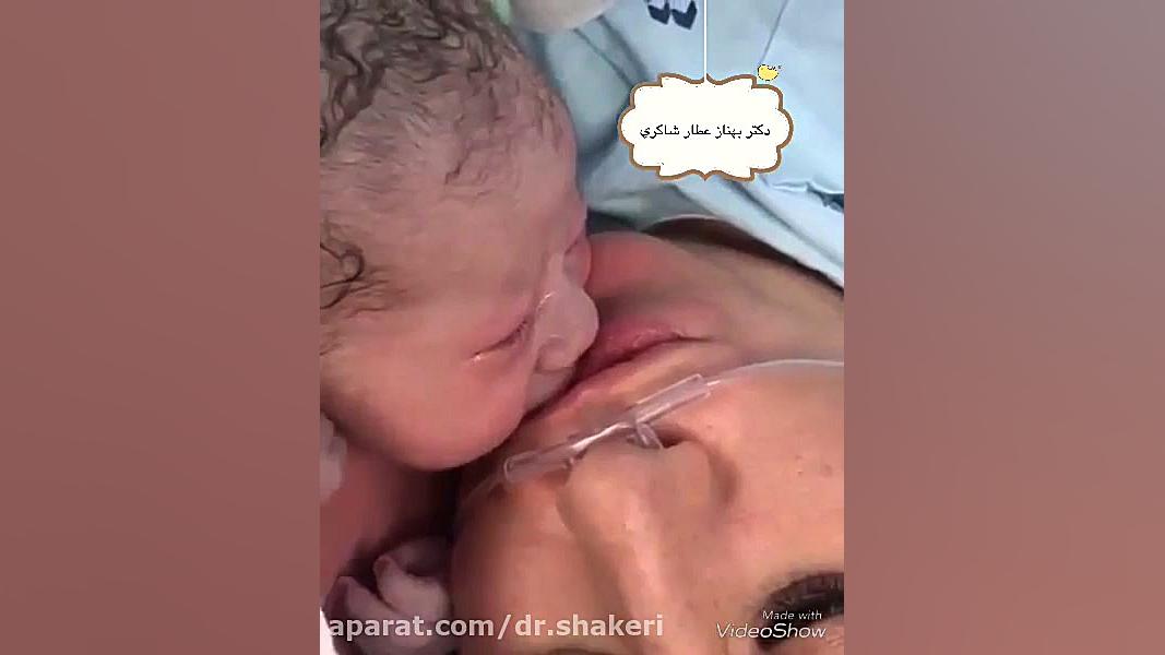 نوزاد تازه متولد شده لیپوست