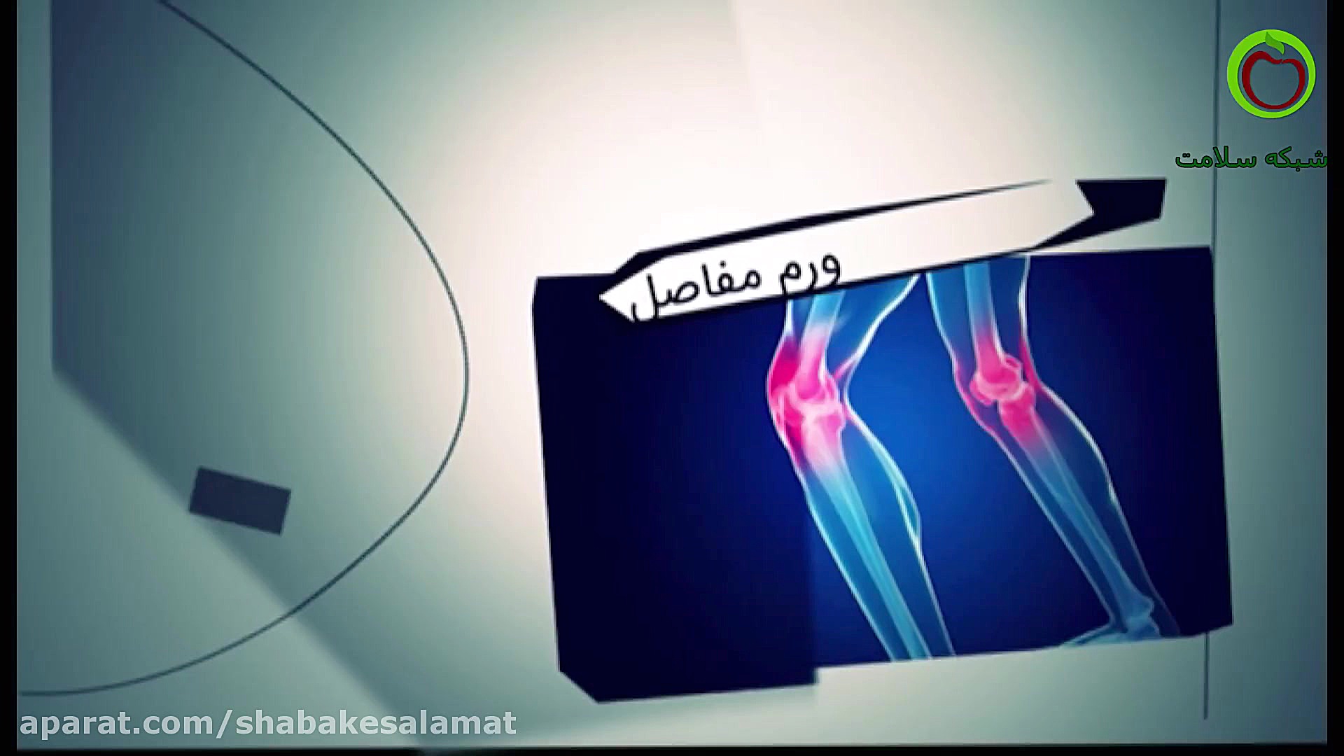 علائم کم کاری تیروئید اصلاح فرم صورت