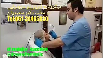 میکرودرم ابریژن برای لایه برداری و جوان سازی پوست آزمایش ایمونوسورپشن