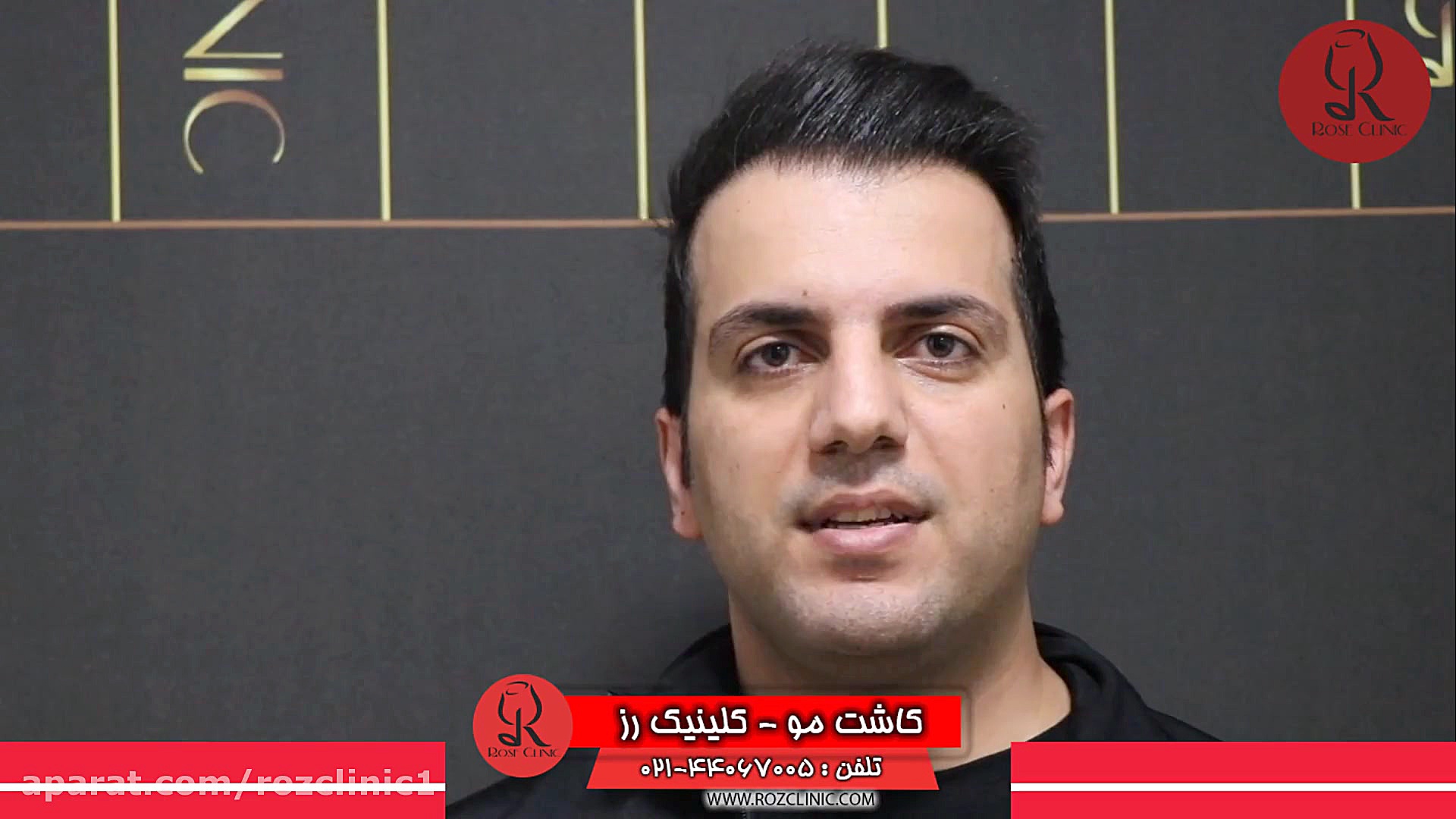 کاشت مو | فیلم کاشت مو | کلینیک پوست و مو رز | شماره22 روکش دندان