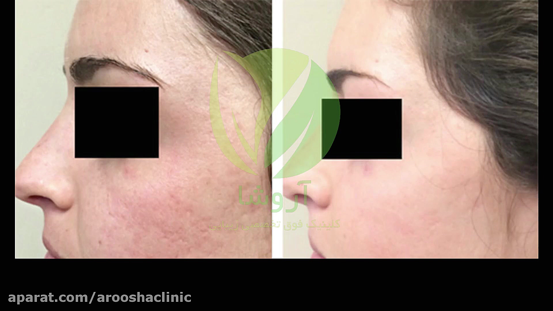 اسکارلت کلینیک زیبائی دکتر مهرشاد رابط