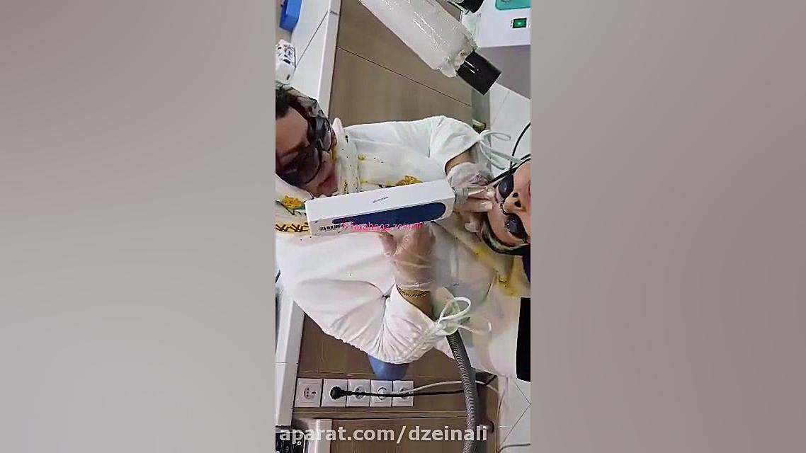 لیزر رفع تاتوی ابرو دکتر فرحناز زینعلی - متخصص پوست، مو، زیبایی زنجان