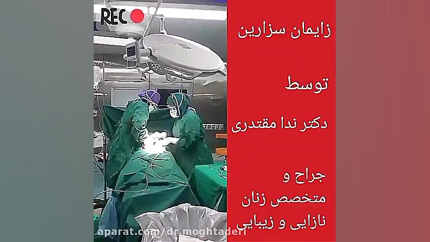 زایمان سزارین توسط دکتر ندا مقتدری متخصص زنان و زایمان در اصفهان جراحی لثه