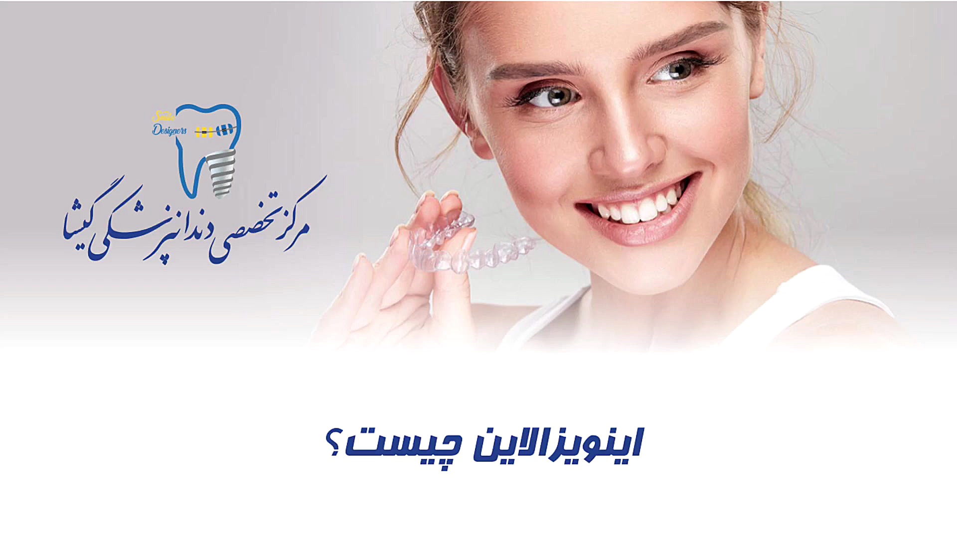 معایب و مزایای الاینر شفاف اینویزالاین کلینیک دندانپزشکی دکتر عزیز گشاده رو