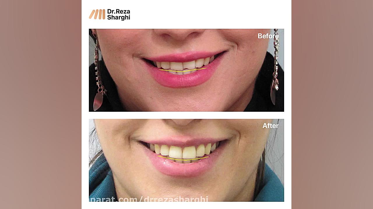روند درمان ارتودنسی مراجعان دکتر رضا شرقی