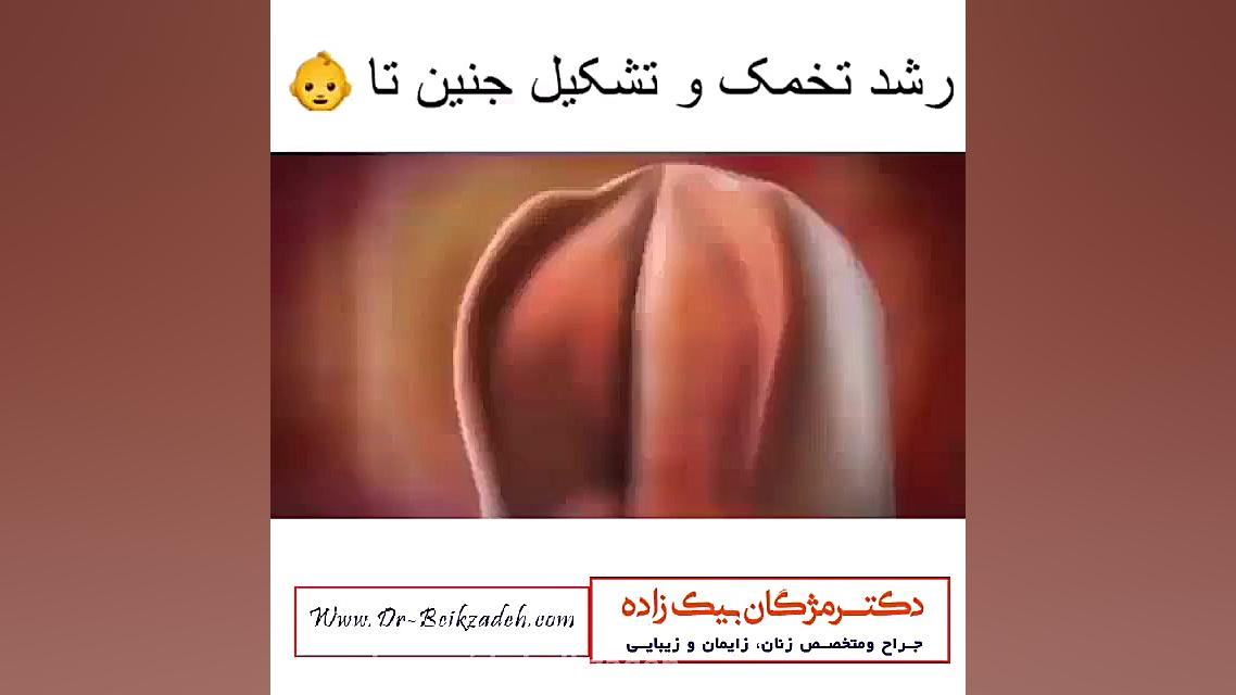 جنین چگونه تشکیل می شود؟ دکتر مژگان بیک زاده ( جراح و متخصص زنان و زایمان)