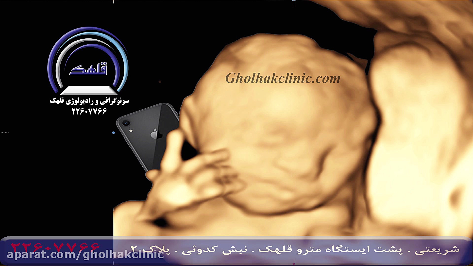 جنین موبایل بدست لیپوست