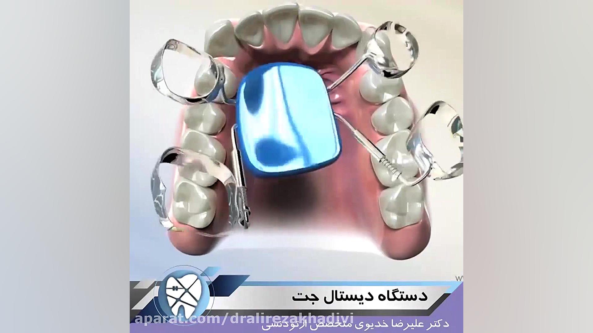 دستگاه دیستال جت دکتر علیرضا خدیوی