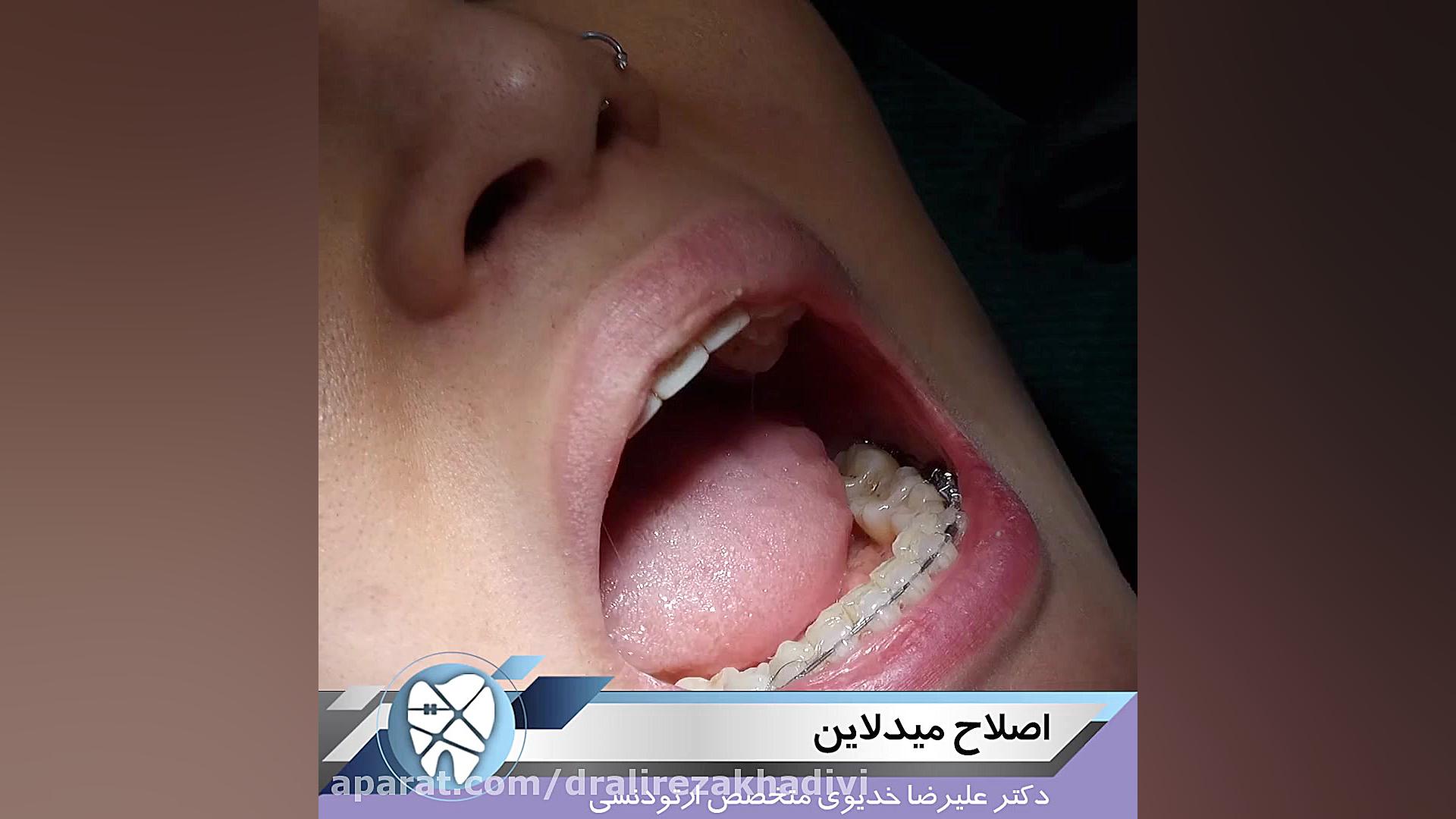 اصلاح میدلاین دکتر علیرضا خدیوی