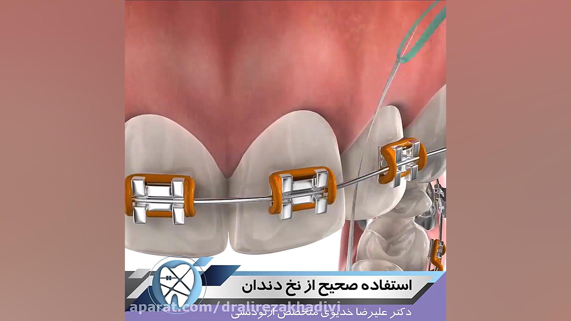 استفاده صحیح از نخ دندان دکتر علیرضا خدیوی