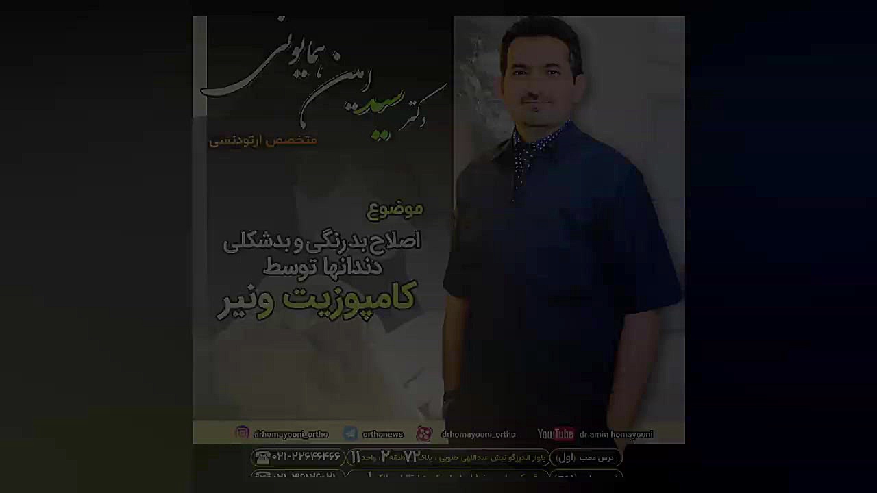 اصلاح بدرنگی و بدشکلی دندانها توسط کامپوزیت ونیر لیفت پیشانی