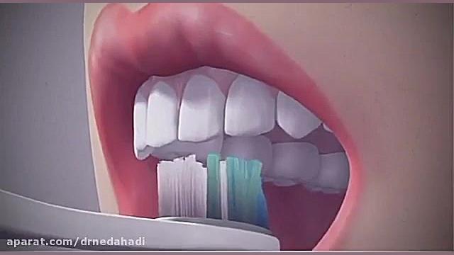 روش صحیح مسواک زدن | دکتر ندا هادی دکتر ندا هادی-دندانپزشک زیبایی