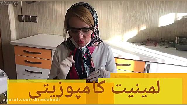 لمینیت كامپوزیتی دندان | دکتر ندا هادی دکتر ندا هادی-دندانپزشک زیبایی