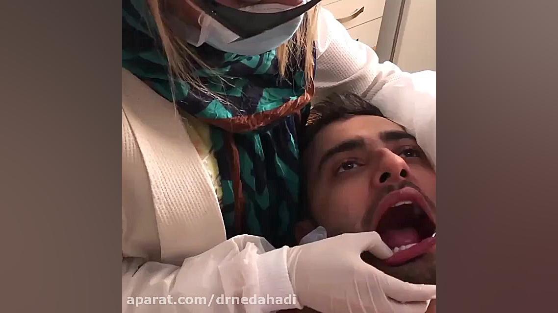 انجام هشت واحد لمینت سرامیکی فک پایین | دکتر ندا هادی دکتر ندا هادی-دندانپزشک زیبایی