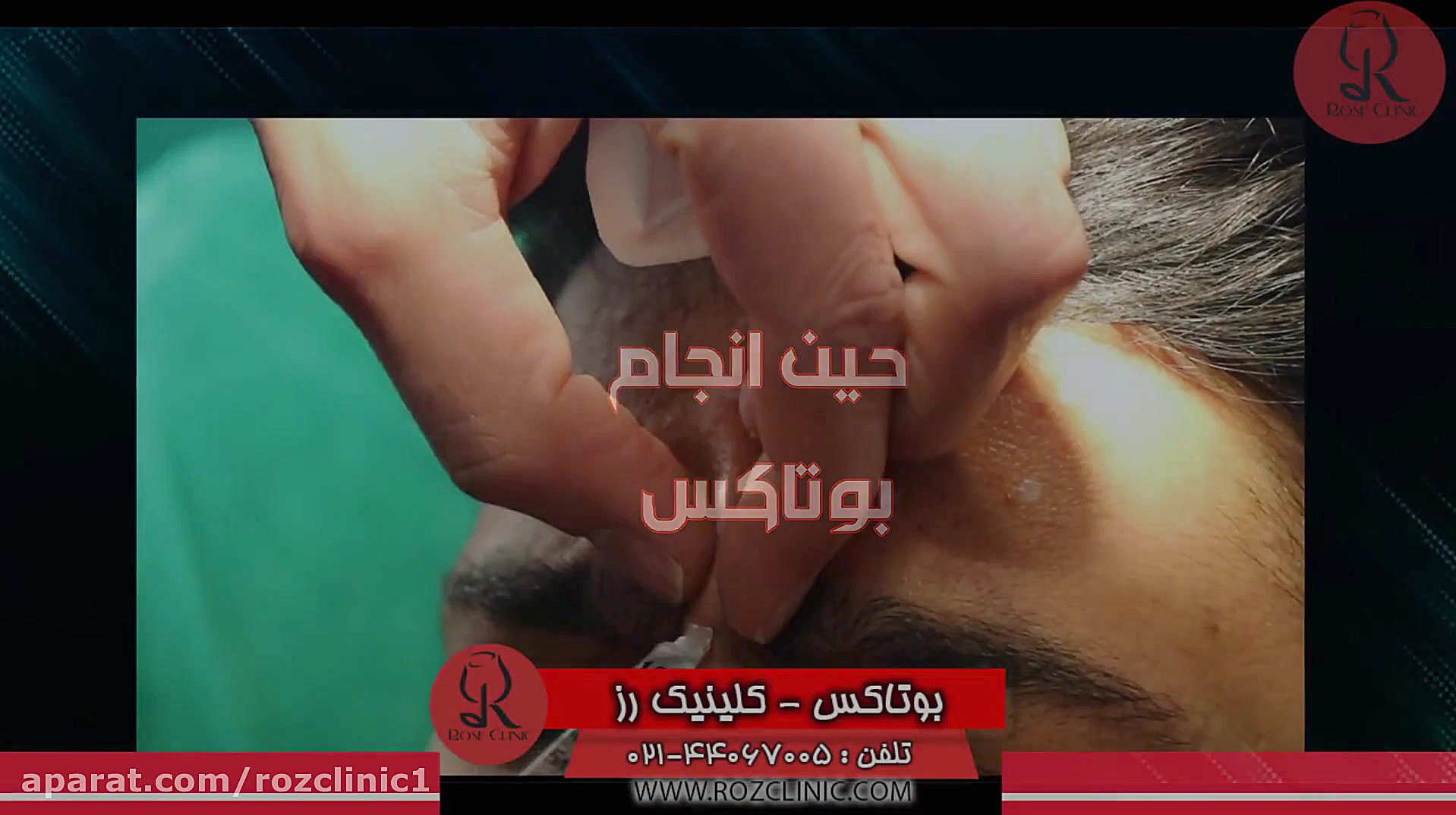 تزریق بوتاکس | فیلم تزریق بوتاکس | کلینیک پوست و مو رز |16 کلینیک لیزر