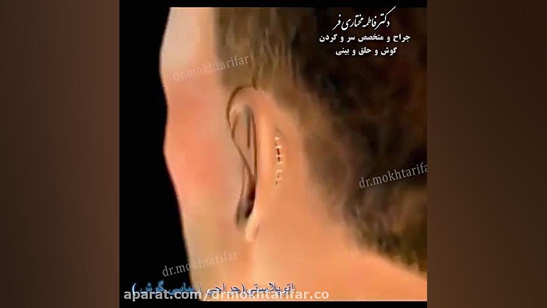 جراحی زیبایی گوش دکتر فاطمه مختاری فر جراح بینی در لرستان