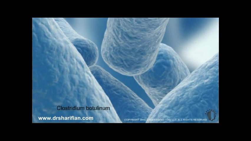 انیمیشن تزریق بوتاکس اریتروبلاستوز جنینی