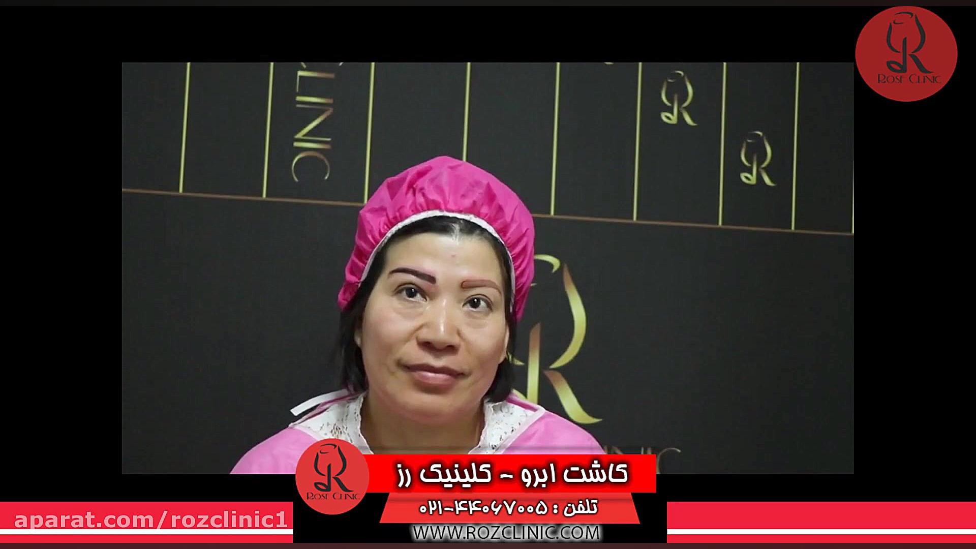 کاشت ابرو | فیلم کاشت ابرو | کلینیک پوست و مو رز | شماره62 بیولوژی پرتوی