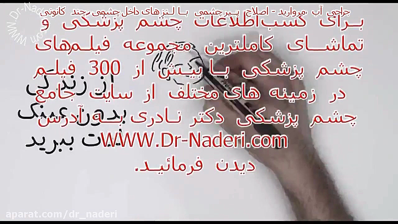 اصلاح پیر چشمی با لنز داخل چشمی چند کانونی - مرکز چشم پزشکی دکتر نادری مرکز چشم پزشکی دکتر علیرضا نادری www.dr-naderi.com