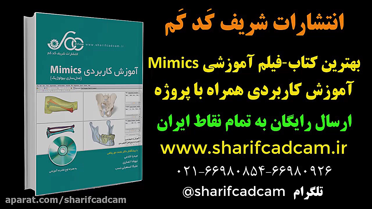 پر کردن قسمت داخلی شفت استخوان Tibia در نرم افزار Mimics برداشتن توده