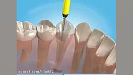 درمان ریشه دكتر محمد رضا سهرابی