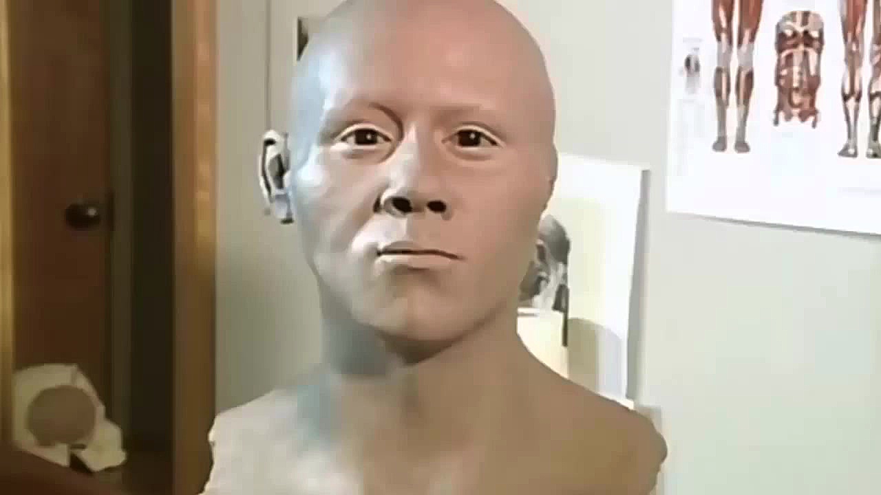 بازسازی تصویر چهره از روی جمجمه در پزشکی قانونی جراحی پف زیر چشم