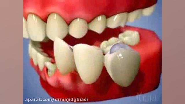 بهداشت دهان و دندان-دکترمجیدقیاسی دندانپزشک زیبایی مشهد دستگاه آنالیز اگزوزوم
