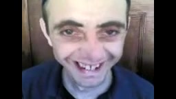 چشم عجیب ابی