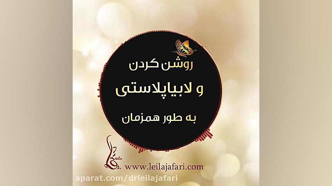 سفید کردن واژن و لابیاپلاستى به طورهمزمان دکتر لیلا جعفری