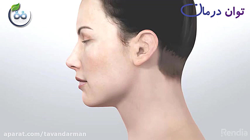 التهاب حنجره چیست؟ بلاگر