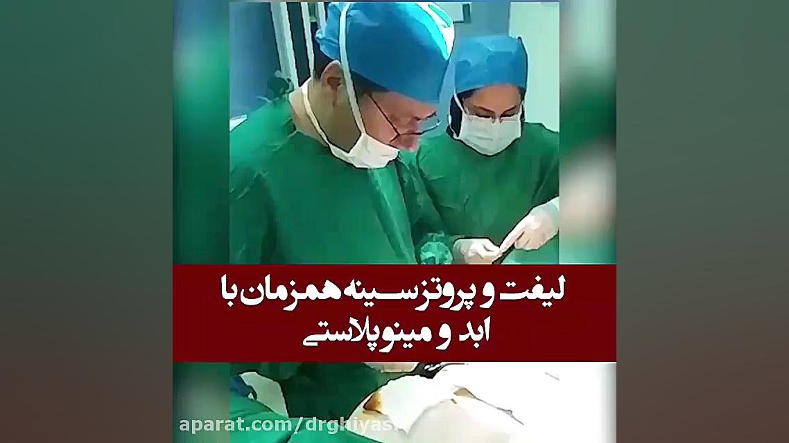 سه جراحی لیفت و پروتز سینه و ابدومینوپلاستی به طور همزمان ! دکتر سینا غیاثی حافظی