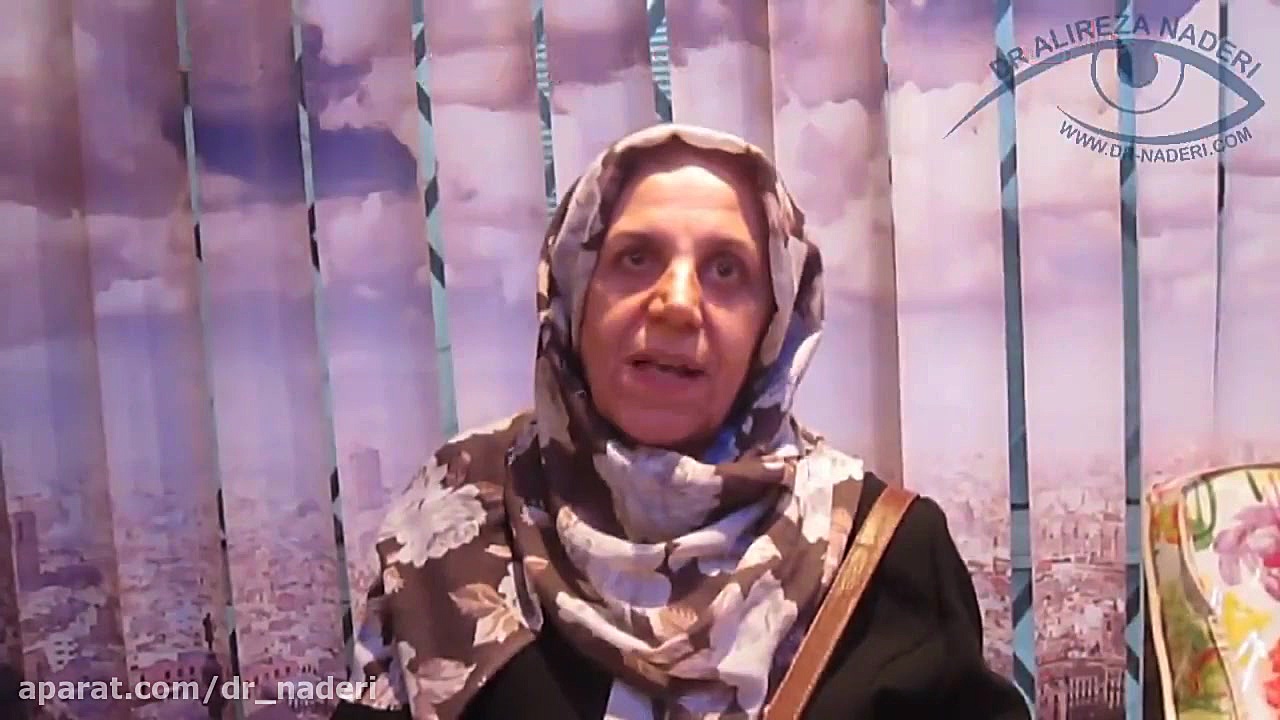 بلفاروپلاستی یا جراحی زیبایی پلک ها در مرکز چشم پزشکی دکتر نادری مرکز چشم پزشکی دکتر علیرضا نادری www.dr-naderi.com