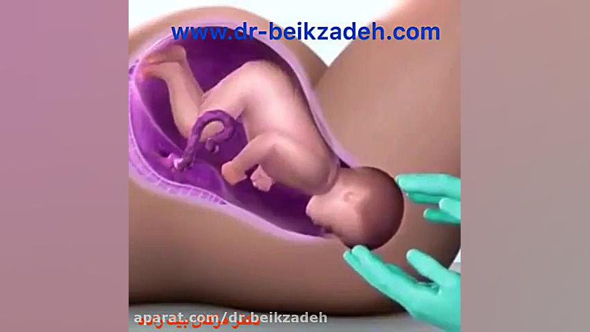 زایمان طبیعی دکتر مژگان بیک زاده ( جراح و متخصص زنان و زایمان)
