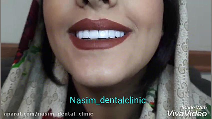 دندانپزشک زیبایی و ترمیمی-کامپوزیت -لمینت جراحی فک