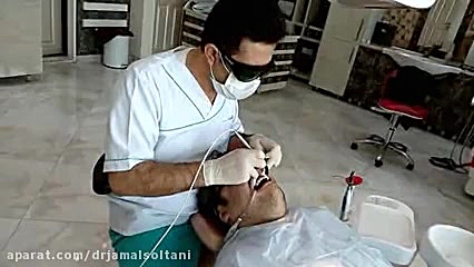 بلیچینگ با لیزر در تبریز دکتر جمال سلطانی دندانپزشک خوب در تبریز