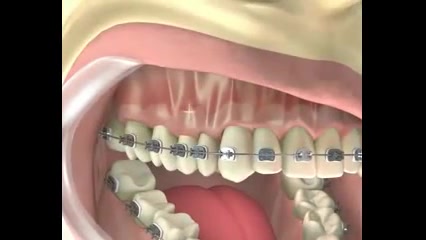 ارتودنسی دکتر سهیل سالاری
