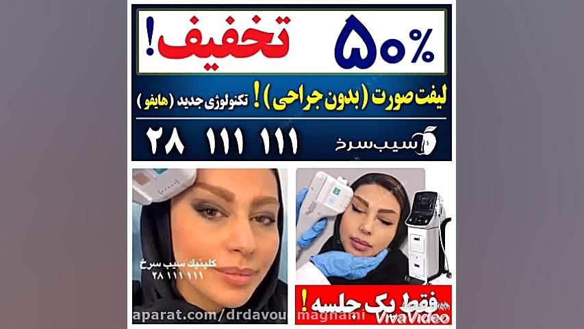 لیفت ابرو ( بدون جراحی - یک جلسه ) ! سندرم چیلبلینز