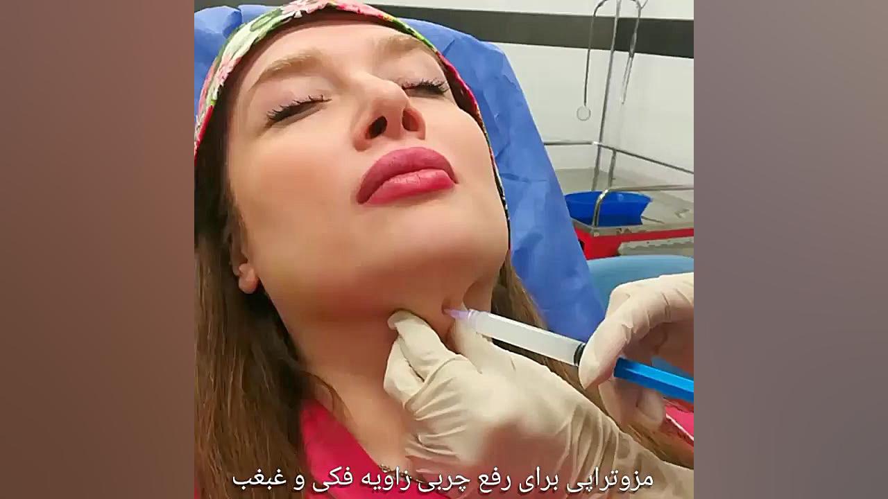 مادلینگ کردن صورت و رفع غبغب با کمترین هزینه در کلینیک تخصصی پوست و مو و زیبایی کاشت مو
