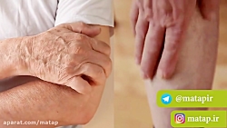 آیا بیماری اگزما مسری است؟