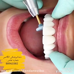 بهترین دندانپزشک زیبایی | بهتر...