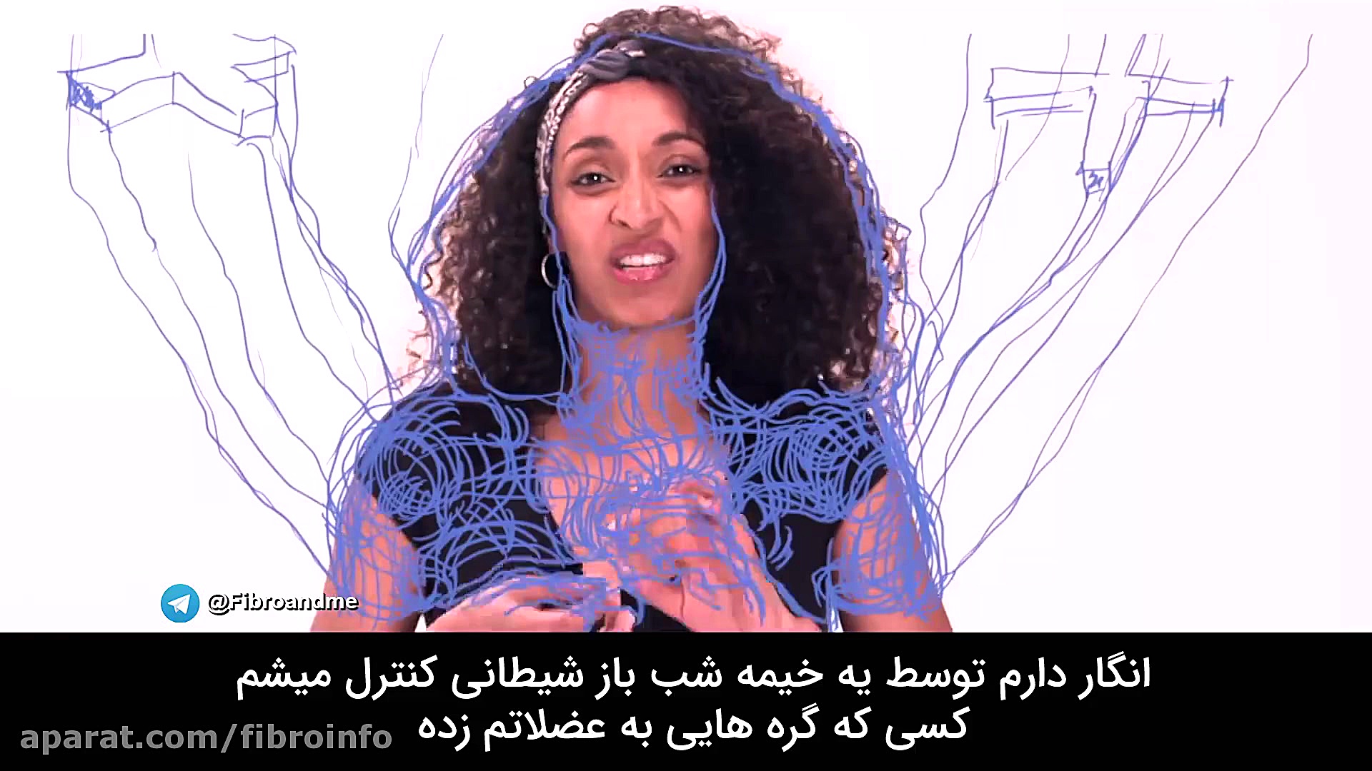 توصیف سندروم فیبرومیالژیا از زبان افراد مبتلا موزیک