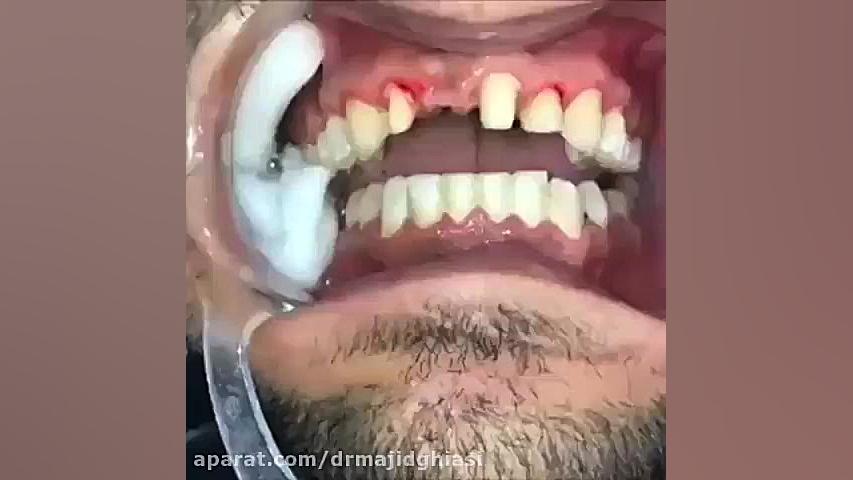 دندانپزشک زیبایی -دکترمجیدقیاسی دکترمجیدقیاسی