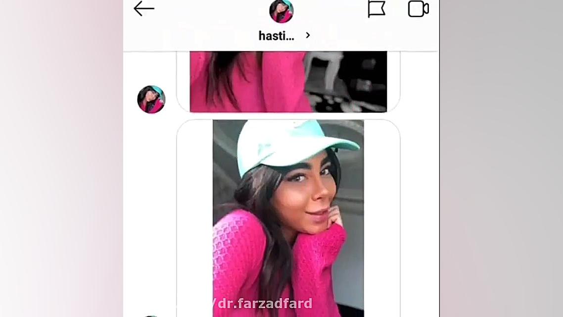 نموذج من جراحه تجمیلیه الانف دکتر اسماعیل فرزاد فرد - فوق تخصص پلاستیک