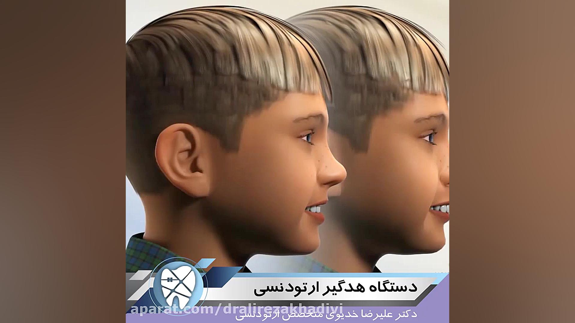 دستگاه هدگیر ارتودنسی دکتر علیرضا خدیوی