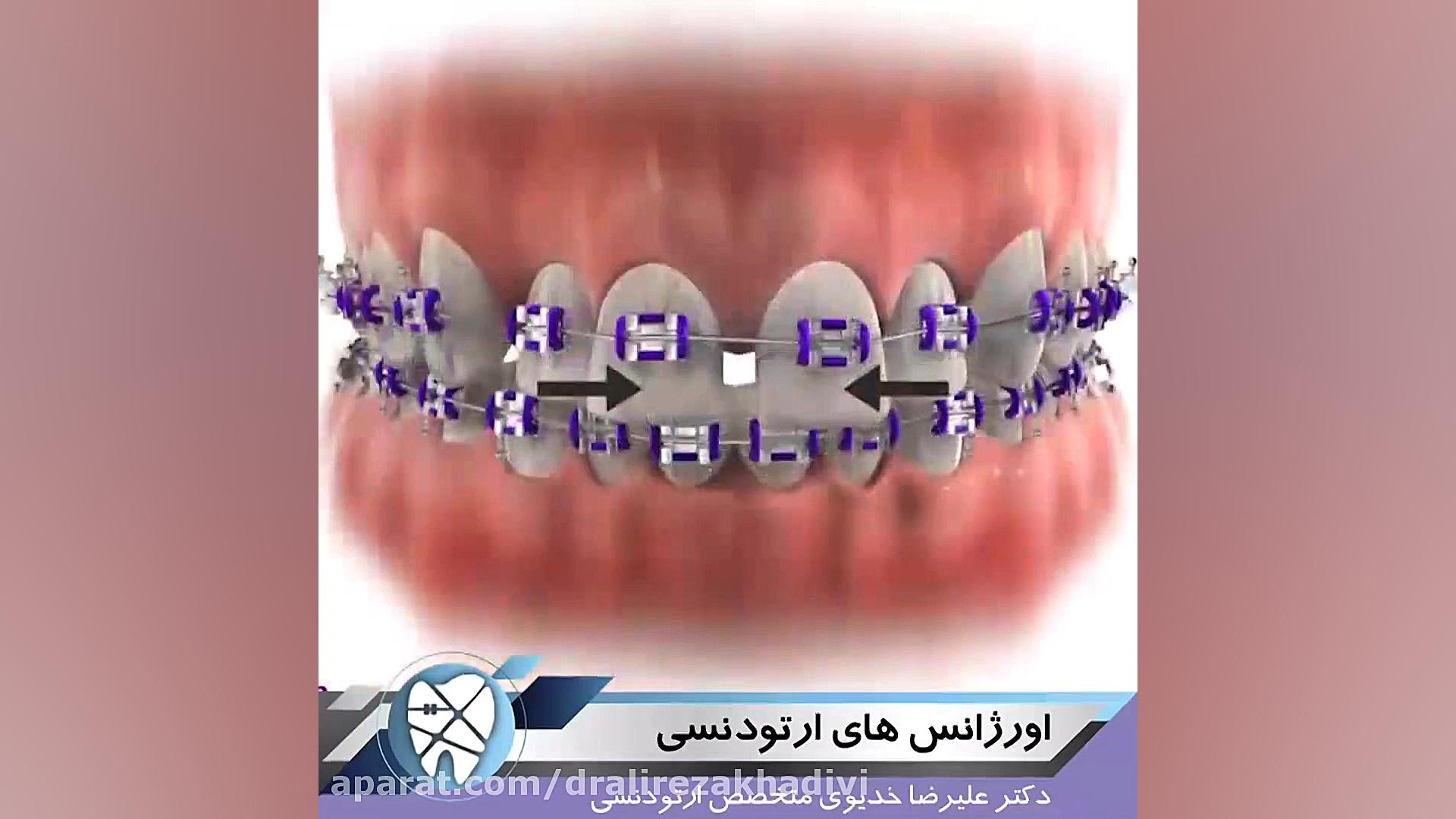 اورژانس های ارتودنسی دکتر علیرضا خدیوی