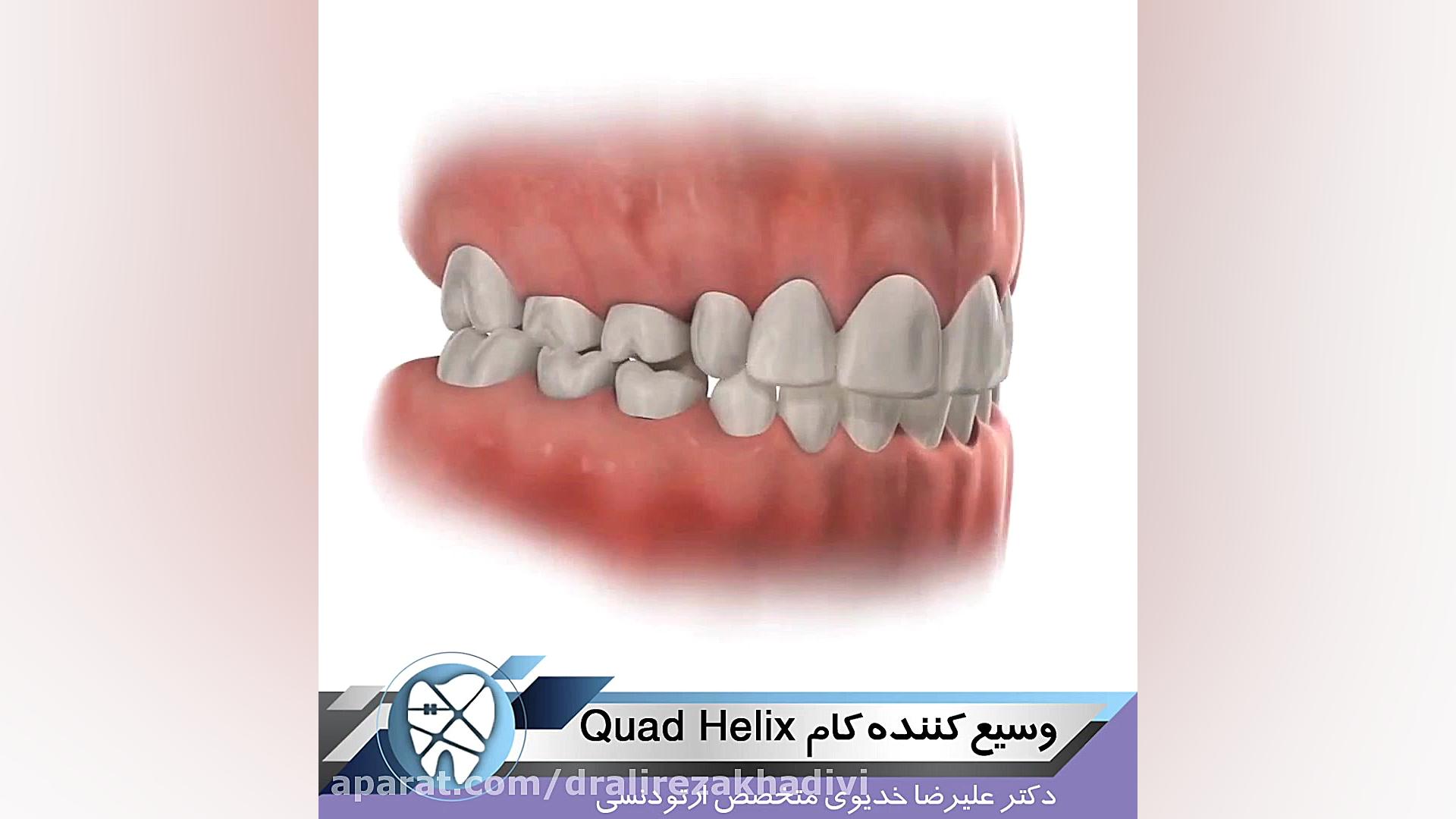 وسیع کننده کام دکتر علیرضا خدیوی
