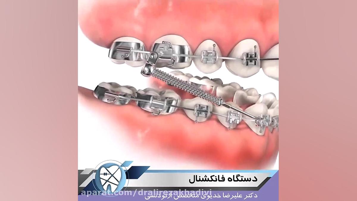 دستگاه فانکشنال دکتر علیرضا خدیوی